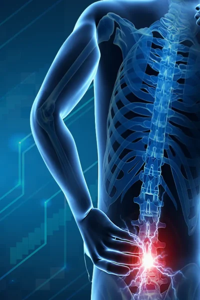 Degenerative Disc