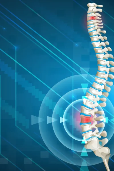 Herniated Disc